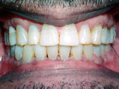 Dr. Ghilzon Orthodontics Case #7 - After